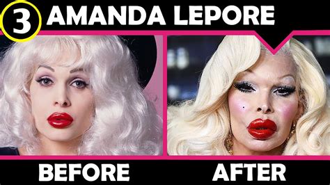 amanda lepore before after